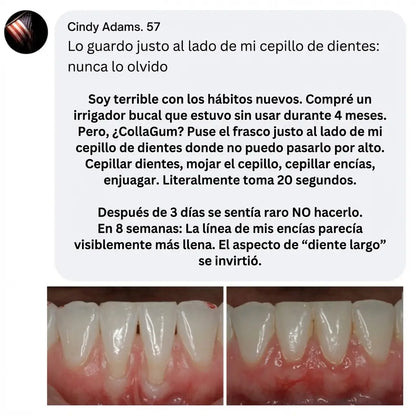 CollaGum™