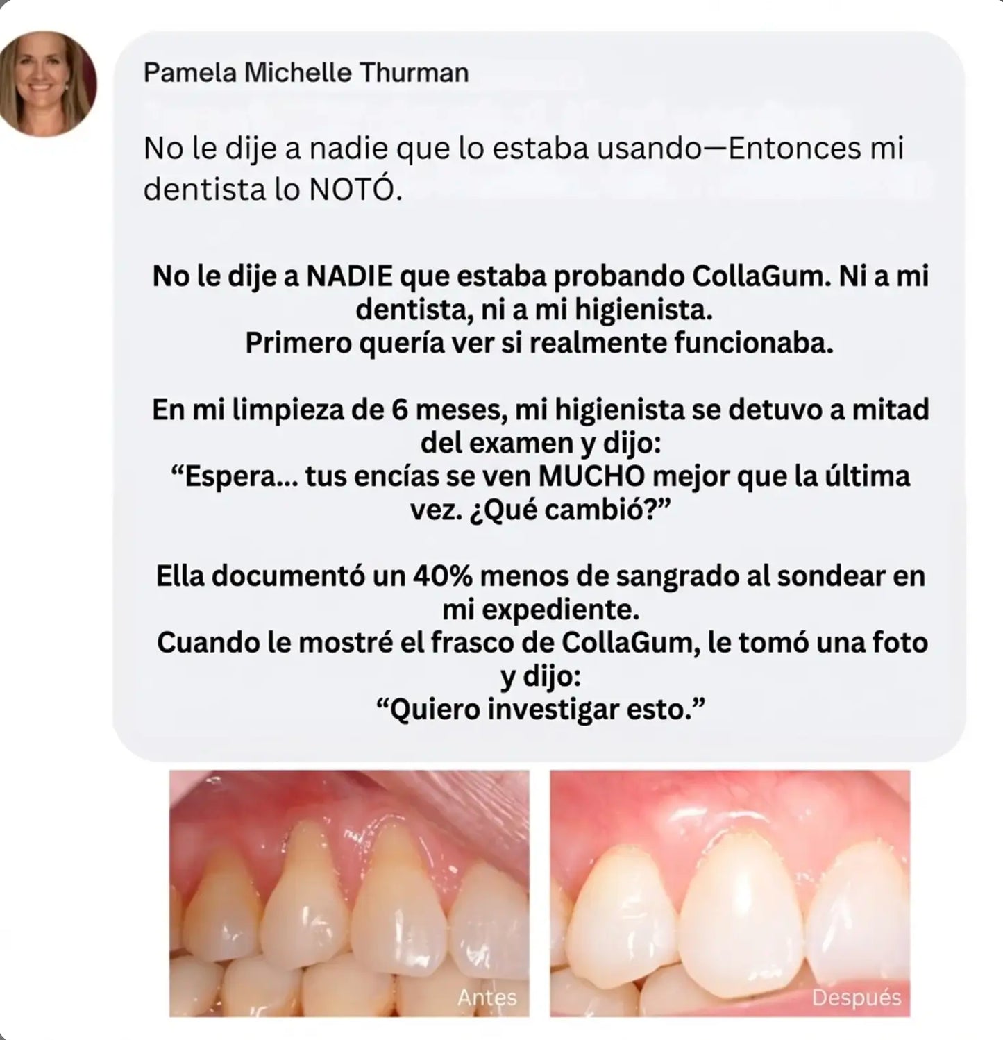 CollaGum™
